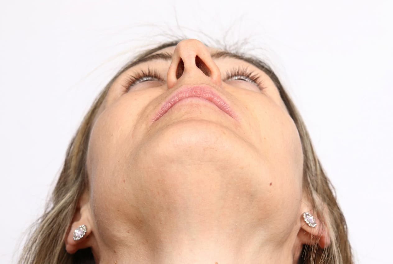 Breathing Through One Nostril? Why Your Septum Might Be to Blame