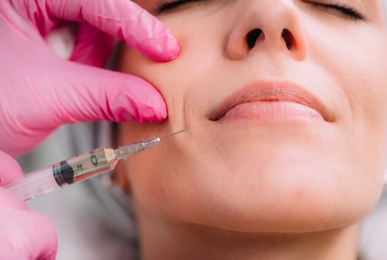 What to Expect at Your First Filler Appointment